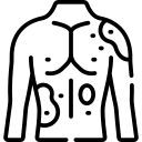 Urticaria y dermatitis atópica